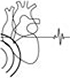 Echocardiogram (echo).